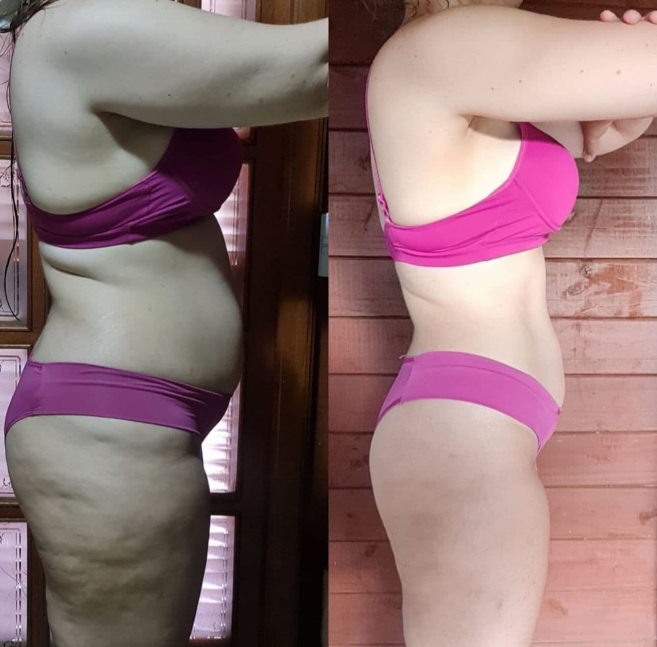 Transformation — Emma, Christchurch